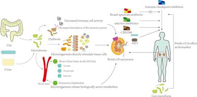 Gut and urinary microbiota: the causes and potential treatment measures of renal cell carcinoma